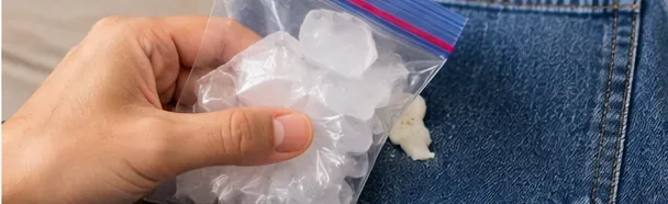 A sealed bag of ice being pressed against chewing gum stuck to blue denim to harden the gum before removal