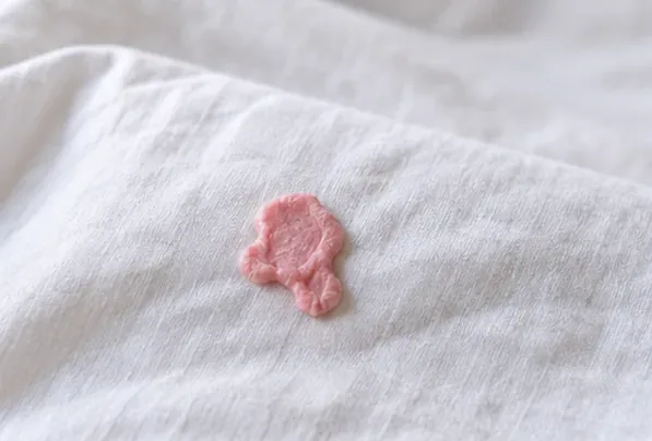 A piece of pink chewing gum stuck to a white bed sheet before treatment