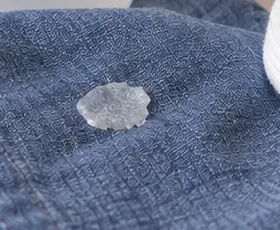 A small hardened clear nail-glue spot resting on blue woven fabric before treatment